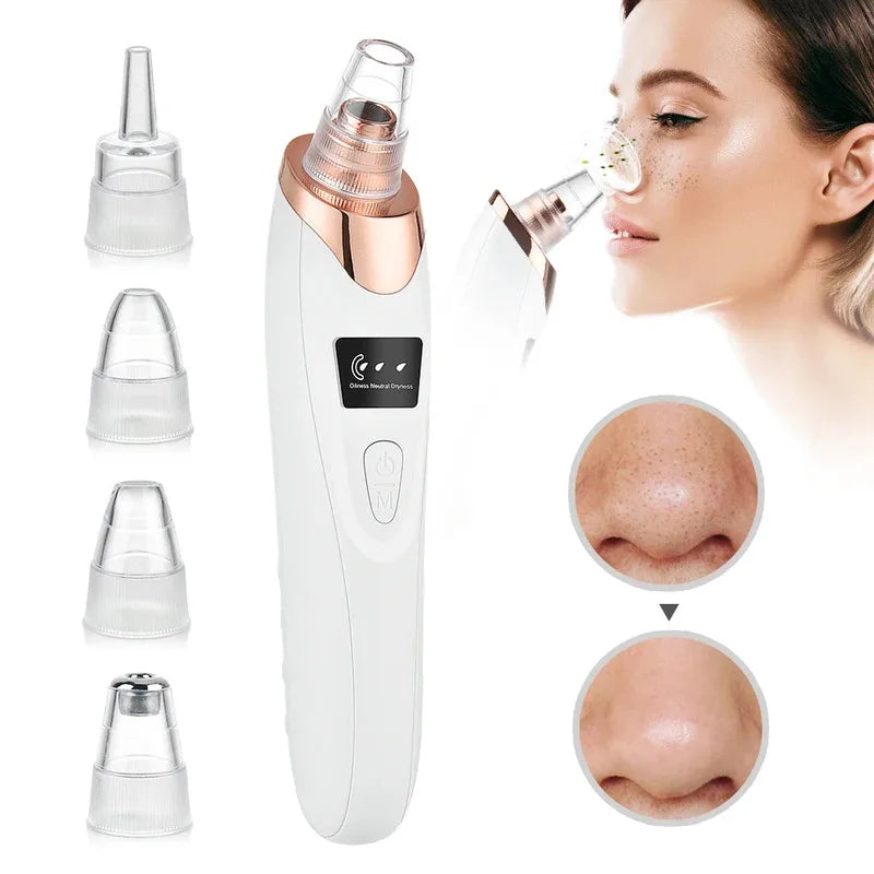 Electric Blackhead Remover Vacuum