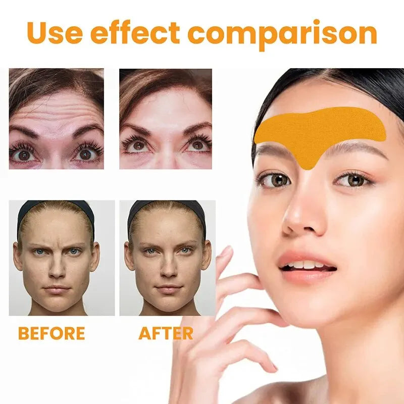 Forehead Wrinkle Patch