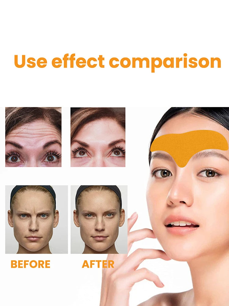 Forehead Wrinkle Patch
