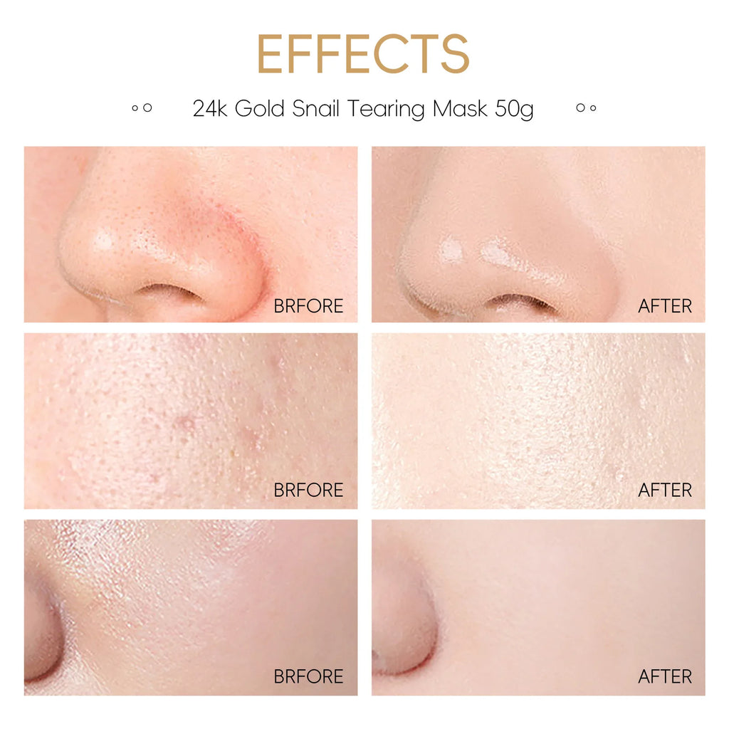 LAIKOU 24K Gold Snail Peel Mask